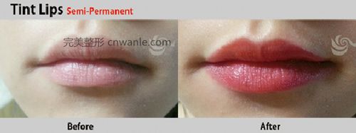 韓國半永久化妝 紋唇