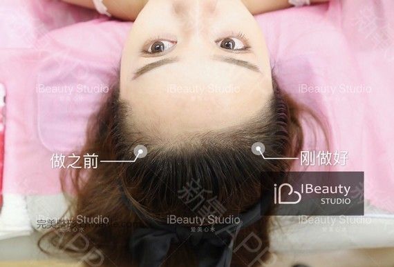 術(shù)后當(dāng)自強(qiáng)