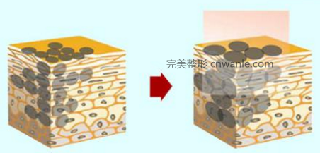 <a href='/tag_jiguangqubanhou4.html'>激光祛斑后</a>遺癥