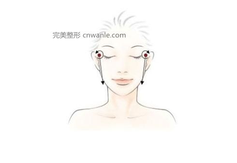 開眼角手術需要多長時間的恢復期