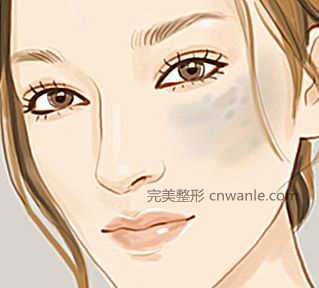 <a href='/tag_changshayixing.html'>長(zhǎng)沙藝星</a>激光點(diǎn)痣效果怎么樣呢？