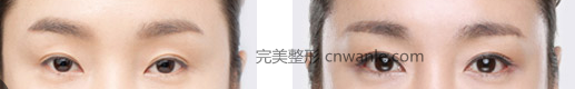 開眼角