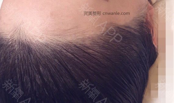 術后當自強 術后當自強