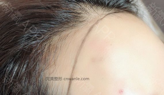 術(shù)后當(dāng)自強(qiáng)