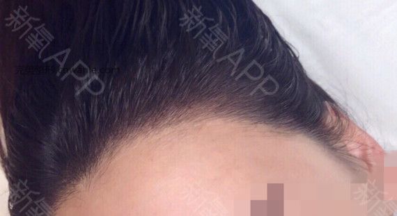 術后當自強 術后當自強