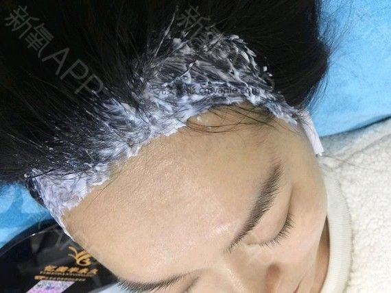 半永久紋發(fā)際線 半永久紋發(fā)際線