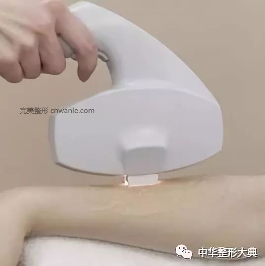 冰點脫毛的操作步驟及優(yōu)勢 | 科普篇?