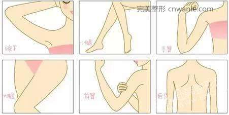 北京美天冰點(diǎn)脫毛