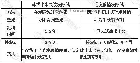 半紋發(fā)際線好還是毛發(fā)移植好