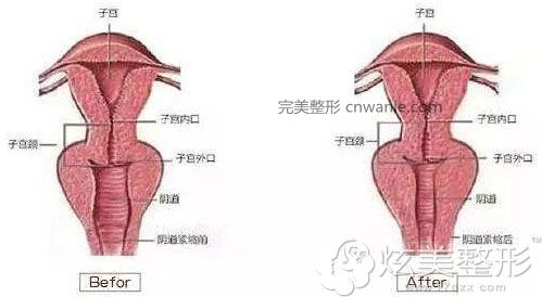 引導(dǎo)緊縮原理圖韓國好手藝 引導(dǎo)緊縮原理圖韓國好手藝
