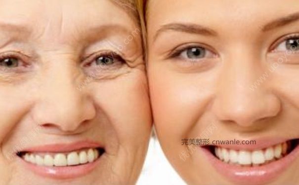 電波拉皮能維持多久?電波拉皮和超聲刀區(qū)別(1)