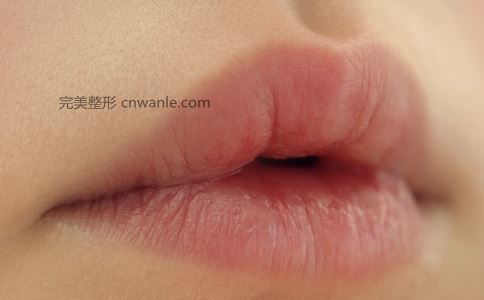 哪些人適合做唇部整形 唇部整形的方法有哪些 什么是唇部整形