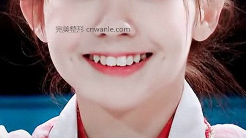 酒窩成形術多久恢復